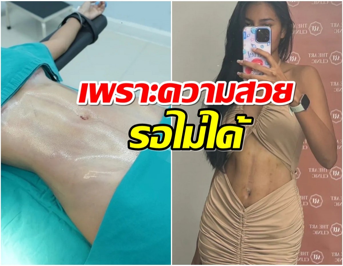 สาวคนดังจัดชุดใหญ่ ดูดไขมันปั้นหุ่นใหม่ พร้อมชิงมงอีกครั้ง