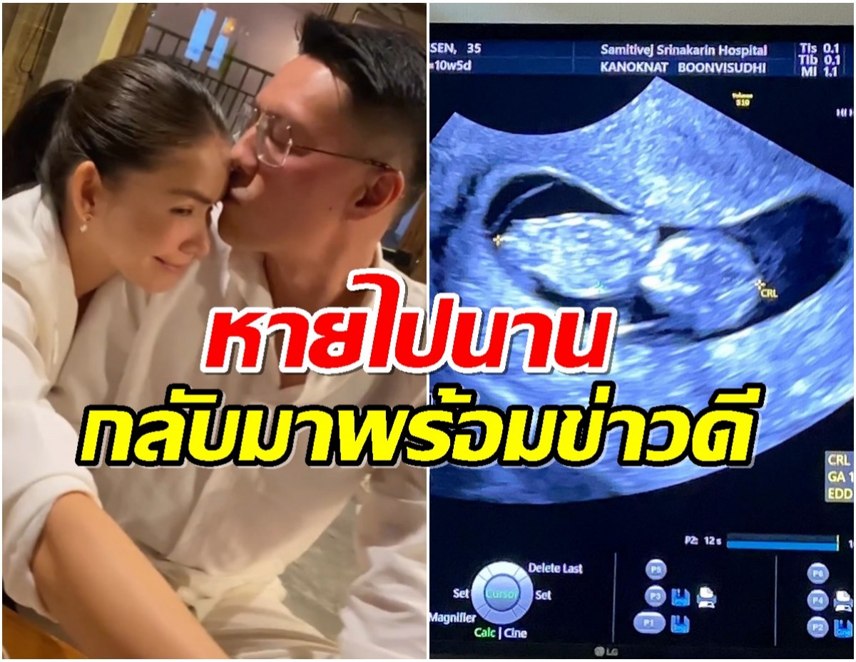 จำเธอได้มั้ย? อดีตนักเเสดงสงครามนางงาม ล่าสุดท้องเเล้ว