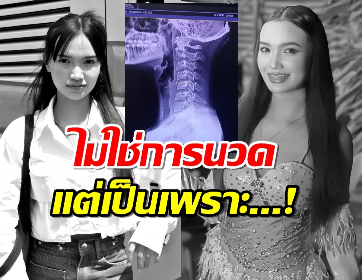 ผล MRI ผิง ชญาดา ชี้ชัดไม่ได้เสียชีวิตจากการนวด แต่เป็นเพราะ...