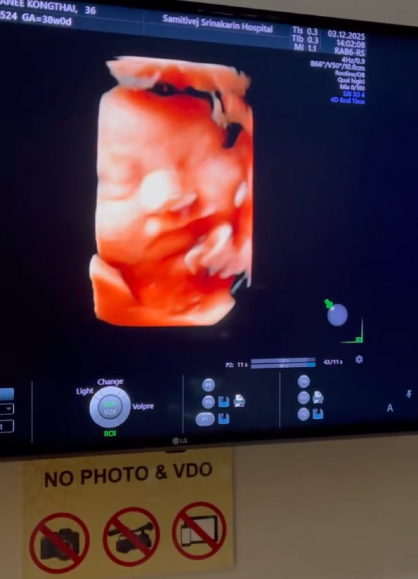 เเมท-เฟม อวดโฉมลูกชายครั้งเเรก น้องภีรันทร์จ้ำม่ำมาก