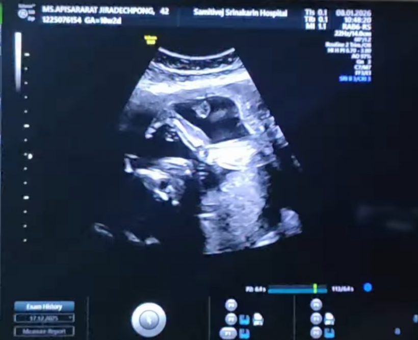 คนบันเทิงแห่ยินดี หนุ่มดังคนนี้ มีทายาทคนแรกแล้ว