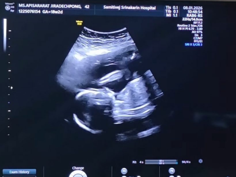 คนบันเทิงแห่ยินดี หนุ่มดังคนนี้ มีทายาทคนแรกแล้ว