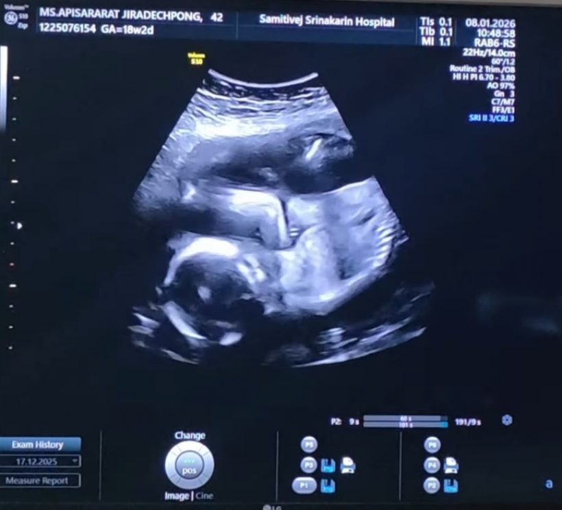 คนบันเทิงแห่ยินดี หนุ่มดังคนนี้ มีทายาทคนแรกแล้ว