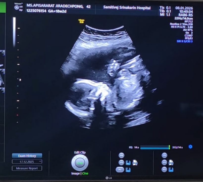 คนบันเทิงแห่ยินดี หนุ่มดังคนนี้ มีทายาทคนแรกแล้ว