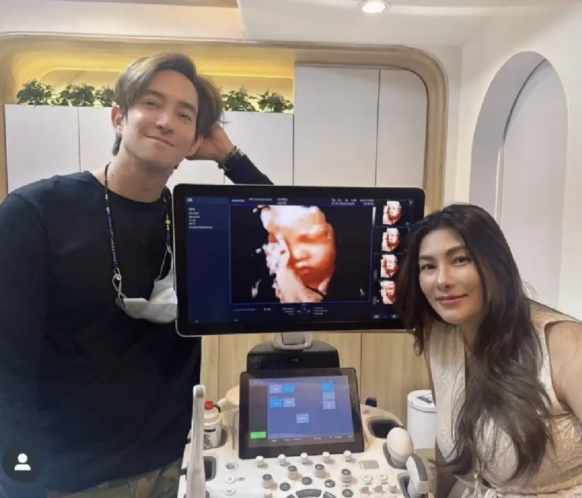 ย้อน6ปี นุ่น-หลุยส์ สู้เพื่อมีลูก ก่อนฝันสลายโค้งสุดท้าย