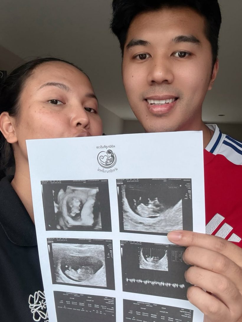 ข่าวดีมาแล้ว! เธอคนนี้ตั้งครรภ์ลูกคนแรก ได้ลูกสาวสมใจ