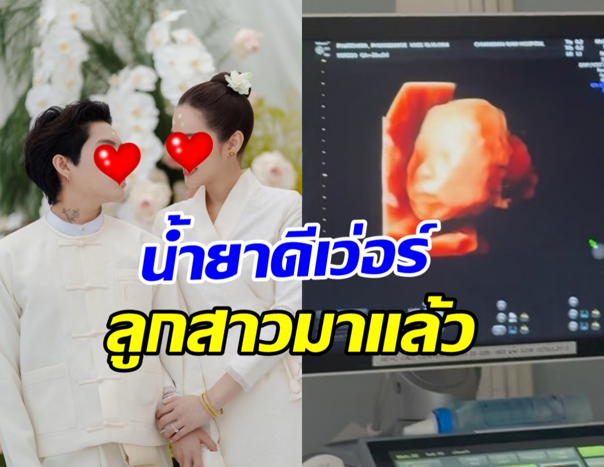 ยินดีด้วย! นางเอกดัง ท้องแล้ว หลังเพิ่งแต่งงานไม่กี่เดือน