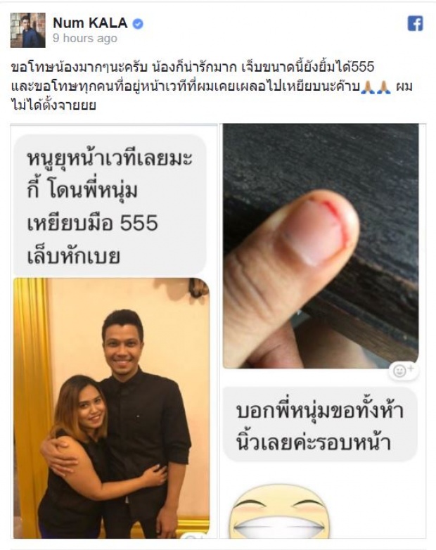 ‘หนุ่ม กะลา’ ออกโรงขอโทษ หลังไปก่อเหตุกับแฟนเพลงจนเจ็บตัว ยันไม่ได้ตั้งใจ