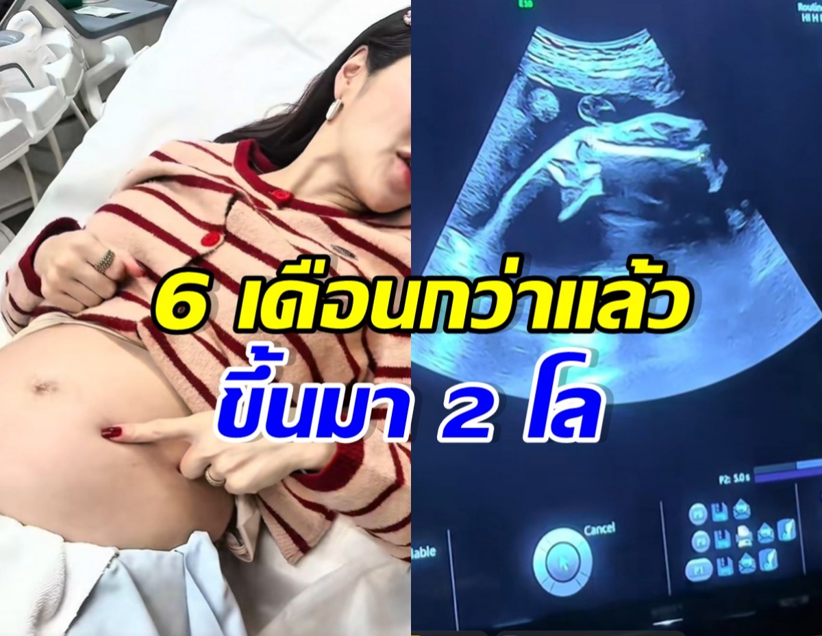 ดาราสาวดัง เผยคลิปอัลตร้าซาวด์ลูกคนที่ 2 คนนี้ขายาวมาก