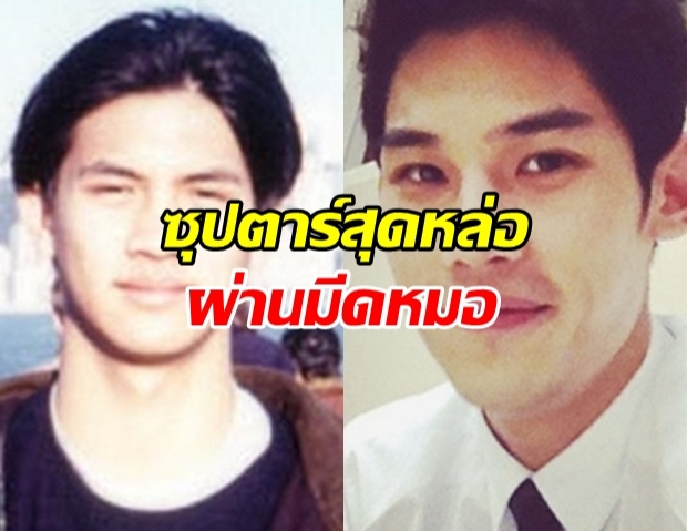 จำแทบไม่ได้! รวมซุปตาร์ชาย ที่ยอมรับว่าทำศัลยกรรม!?!