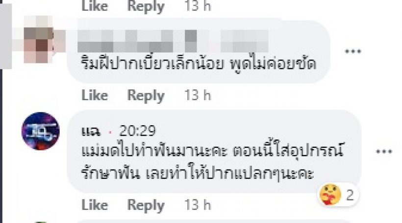 แฟนๆเป็นห่วงผิดสังเกตใบหน้า มดดำ อ่านข่าวแล้วปากเบี้ยว