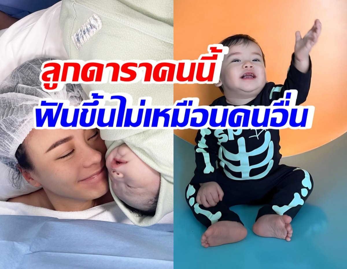 ดาราสาวชื่อดัง รับเป็นห่วงลูกชาย ฟันขึ้นไม่เหมือนเด็กคนอื่น