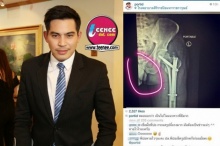 “ปอ” ทำใจคนโฟกัสของลับบนภาพ X-ray