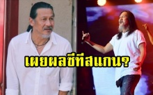 อัปเดตอาการล่าสุด!! แพทย์เผยผลซีทีสแกน “อ๊อฟ พงษ์พัฒน์” แล้ว? (คลิป)