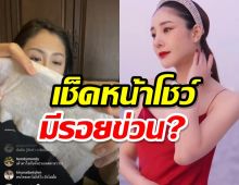 ถูกจับผิดทำไมหน้ามีรอยข่วน แซนเพื่อนแตงโมเช็ดหน้าโชว์ผ่านไลฟ์