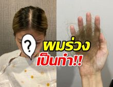 เมียนักร้องช็อค!!ผมร่วงหลังคลอด หลุดติดมือเป็นกำ