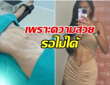 สาวคนดังจัดชุดใหญ่ ดูดไขมันปั้นหุ่นใหม่ พร้อมชิงมงอีกครั้ง