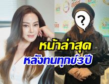 เปิดโฉมล่าสุด จิ๊ก เนาวรัตน์ หลังหายไป เพราะหน้าเบี้ยว