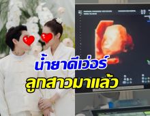 ยินดีด้วย! นางเอกดัง ท้องแล้ว หลังเพิ่งแต่งงานไม่กี่เดือน