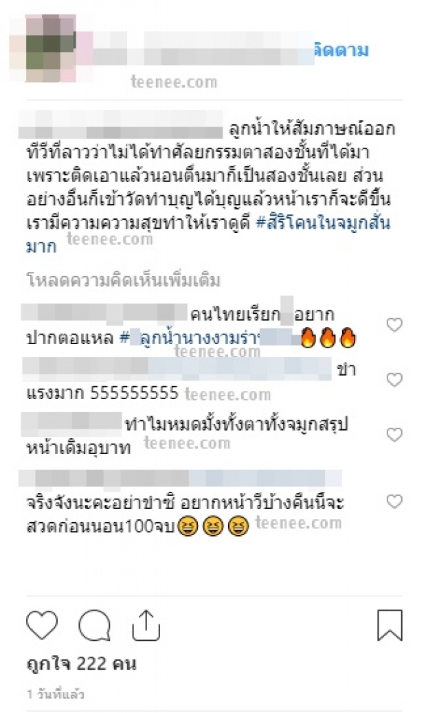  “ลูกน้ำ ทิดาลัด”  ปัด  “ไม่ได้ทำศัลยกรรม”  เผยสวยเพราะเหตุผลนี้! 