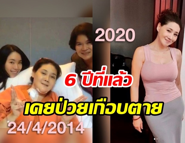 โยโกะ ทาคาโน่ เปรียบเทียบภาพ 6 ปีก่อน ป่วยหนักจนเกือบตาย