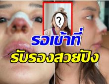 ต้องสวยเเน่! เซเลปสาวอวดจมูกใหม่ หลังเเก้รอบที่ 6 ทรงนี้เข้ากับหน้าสุด