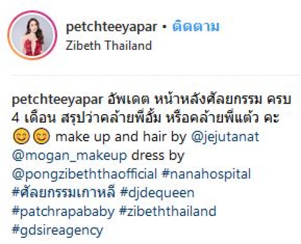 อัพเดตหน้า! น้ำเพชร หลังศัลยกรรม 4 เดือน ลั่นกลางไอจี เหมือนอั้มหรือแต้ว?!