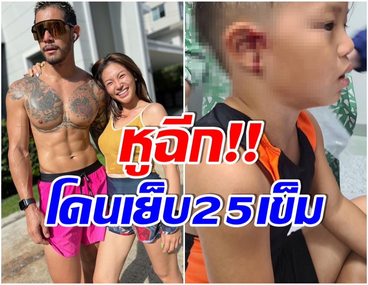 กาย-ฮารุ เจอเรื่องช็อก ลูกชายเลือดอาบหู ในวันที่พ่อเเม่ไม่อยู่เมืองไทย