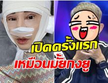 เปลี่ยนไปจริง! พชร์ โชว์หน้าหลังศัลยกรรม ก่อนทำเอารูปกงยูให้หมอดู