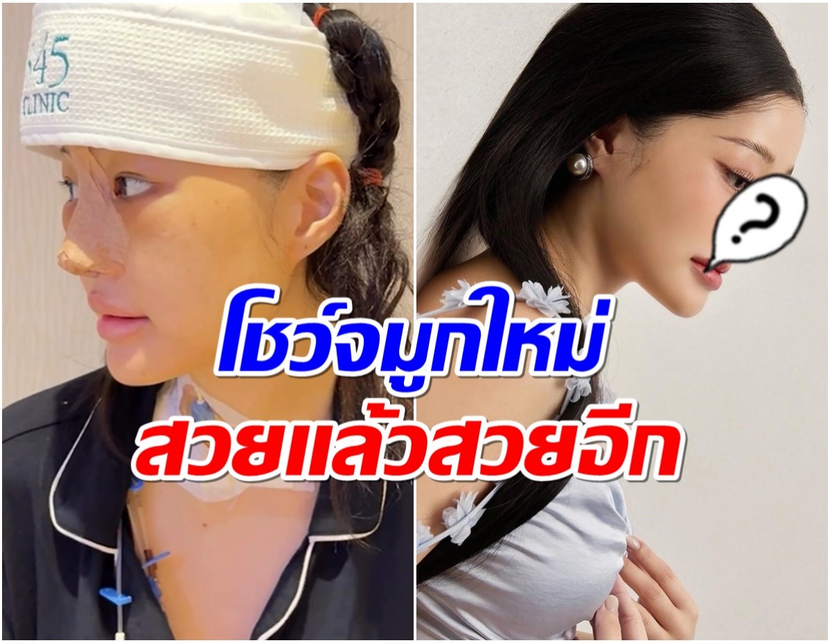 อินฟลูฯสาวอวดจมูกใหม่เข้าที่เเล้ว สวย! นึกว่าดาราจีน