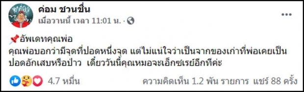 อัปเดตล่าสุด อาการ น้าค่อม พบสิ่งแปลกปลอมที่ปอด