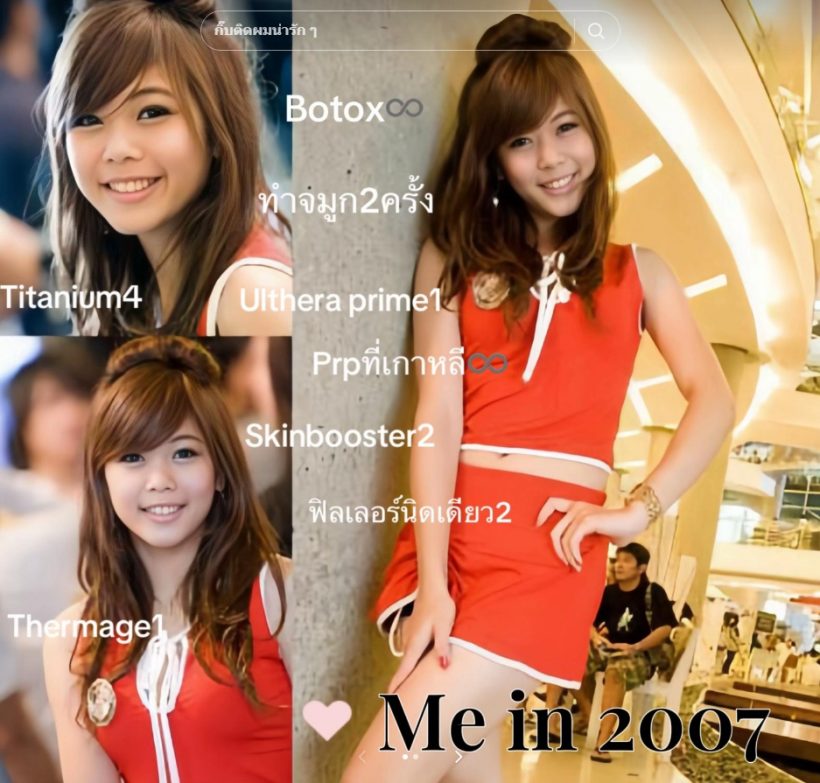 กุ๊บกิ๊บ เทียบพัฒนาการหน้าอดีต-ปัจจุบัน ทำอะไรมาแล้วบ้าง