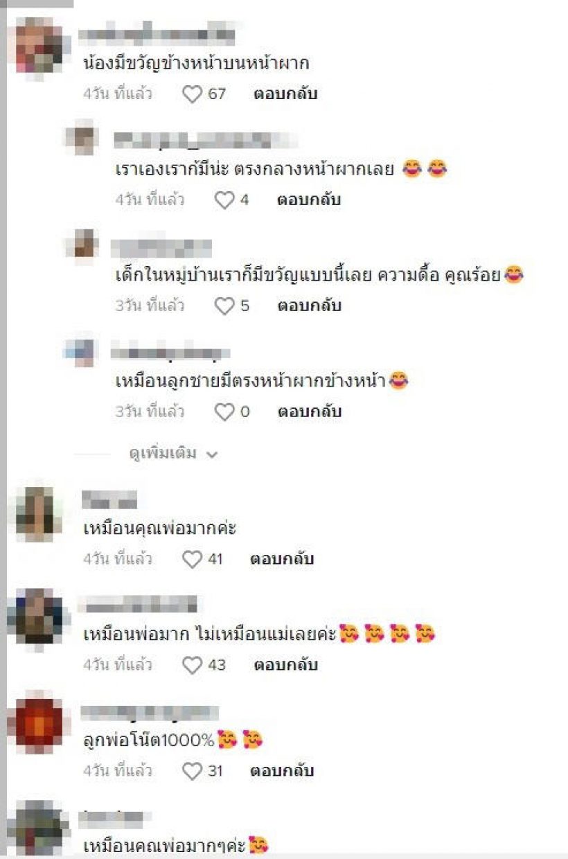 ชาวเน็ตสะดุดตา หน้าผากน้องเอลิเซีย ทายาทหมื่นล้านคนล่าสุด