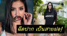 ซูมชัดๆ! ใบเตย อาร์สยาม หลังไปฉีดปากมา พลิกลุคเป็นสายฝอ