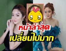  แก้มบุ๋ม โชว์ใบหน้าล่าสุดหลังเติมฟิลเลอร์ ลั่นต้องฉีดให้โลกรู้ไปเลย