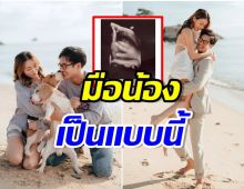 วิกกี้เมียเวียร์ อวดภาพอัลตร้าซาวด์ลูกในท้อง มือน้องทำหลุดโฟกัส