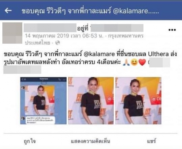 โป๊ะเเตก! ชาวเน็ตขุดหลักฐานเด็ด กาละเเมร์หน้าเด้งเพราะ คลินิก 