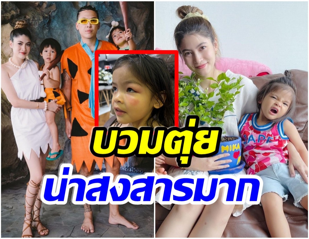 ตกใจ! มาร์กี้ เเชร์ภาพใบหน้าน้องมีญ่า เเดง-บวม ไปโดนอะไรมา