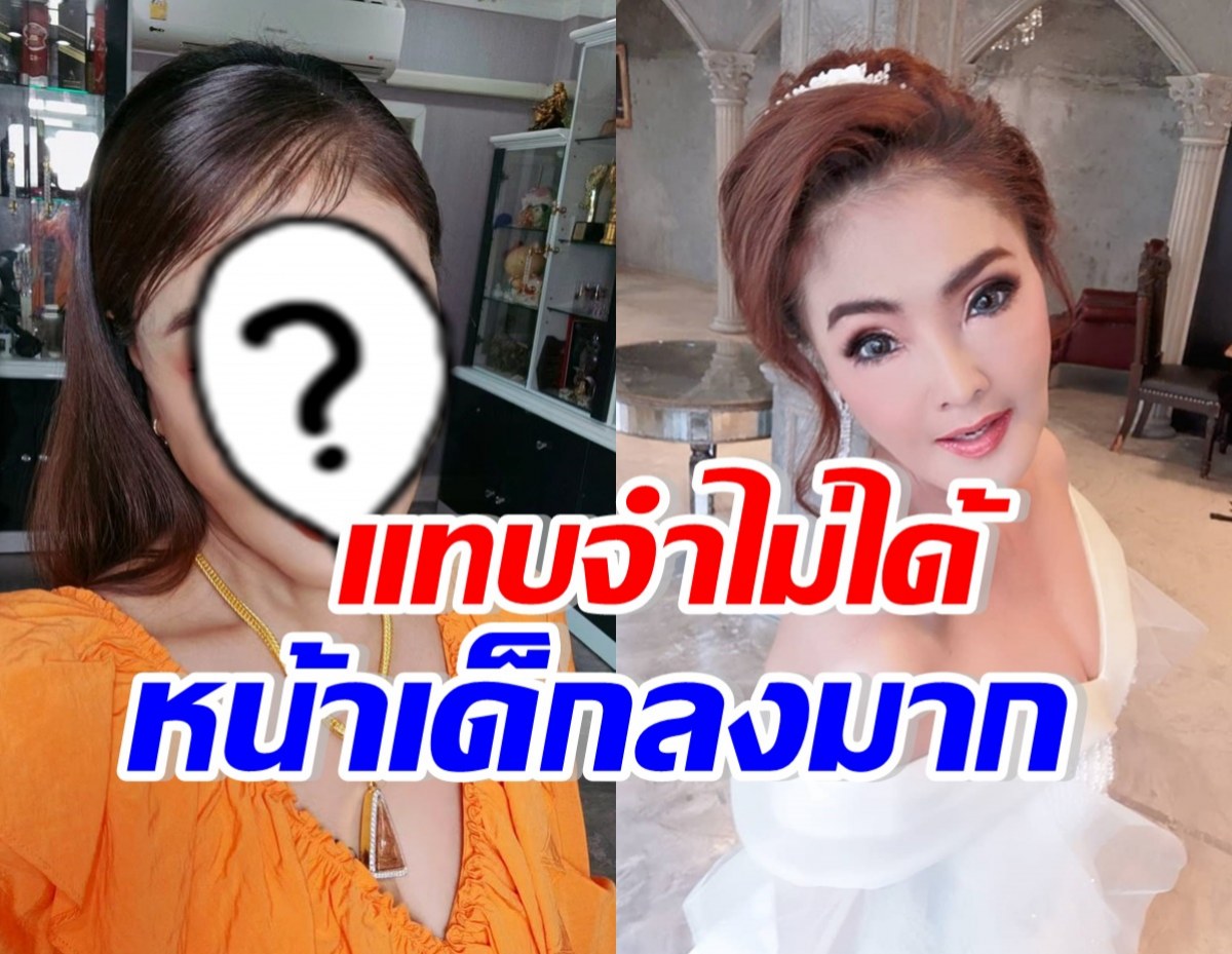 เปิดโฉมล่าสุด ดาว มยุรี หลังทำจมูกใหม่20วัน อึ้งหน้าเด็กลงมาก