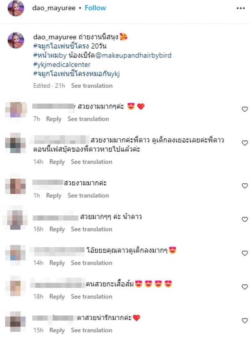 เปิดโฉมล่าสุด ดาว มยุรี หลังทำจมูกใหม่20วัน อึ้งหน้าเด็กลงมาก