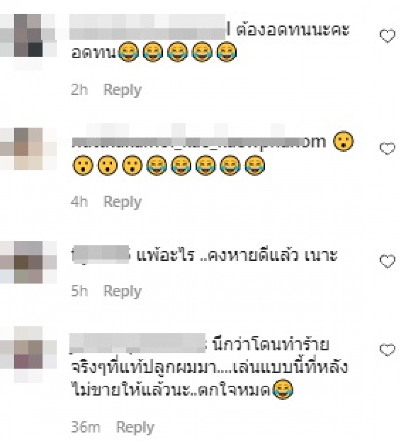 แฟนคลับตกใจ แจ๊ค ธนพล หน้าบวมตุ่ย จ๊ะ ลั่นบอกแล้วว่าอย่า!