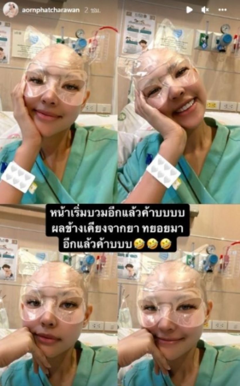 หน้าบวม! ภาพล่าสุด ออน พัชรวรรณ รองนางสาวไทย หลังป่วยมะเร็งต่อมน้ำเหลือง