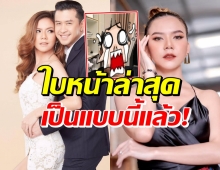 แฟนคลับตกใจ แจ๊ค ธนพล หน้าบวมตุ่ย จ๊ะ ลั่นบอกแล้วว่าอย่า!