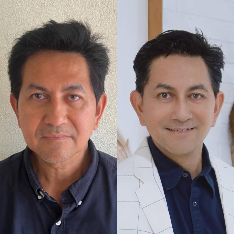 ยลโฉมหน้าใหม่ ดุ๊ก ภาณุเดช หล่อกระชากอายุ 51 ปี